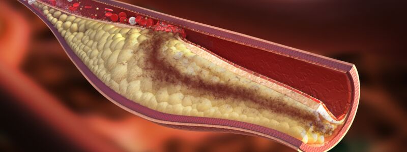 Cross section of blood vessel