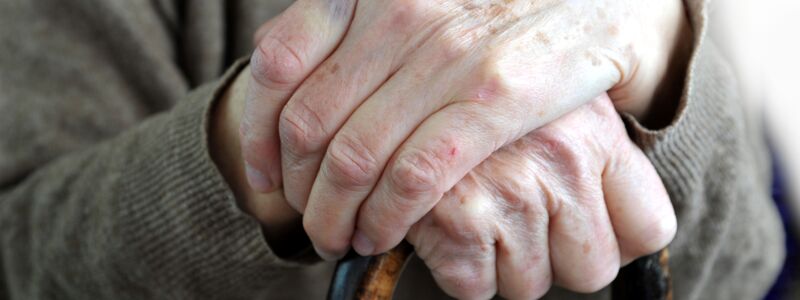 Old hands with age spots